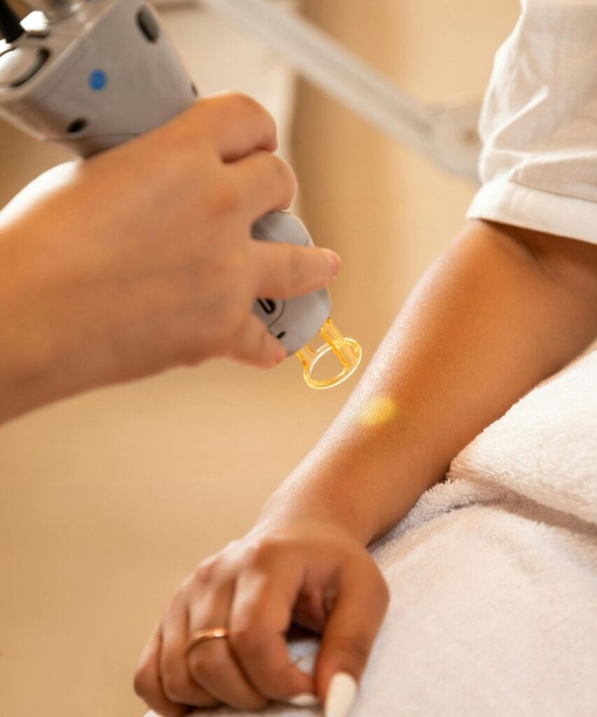 Person's forearm, resting on towel, small dot of yellow light on skin from a handheld tool. Text on image: Body Sculpting, Lift, tighten, tone & freeze
